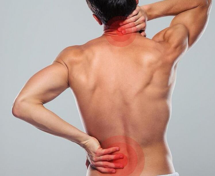 A man has spinal osteochondosis